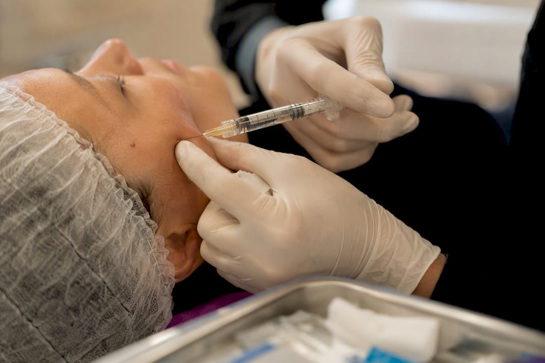Close-up of filler injection technique
