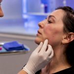 One in Eight: Dermal Filler Complications Patients & Clinics Must Spot