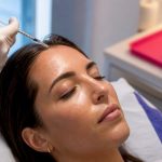 Shrink Pores and Sebum: Microbotox Technique for UK Clinicians