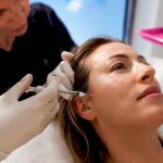 Visible Skin Remodelling in 6–8 Weeks With Profhilo for UK Clinics