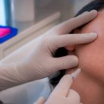 Safety, Technique, 2–4 Sessions: Skin Booster Injections for Clinicians