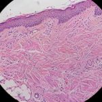 Regenerative Aesthetics: True Renewal or Biostimulation for UK Clinicians