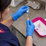 Botulinum Toxin Dilution Chart for UK Practitioners