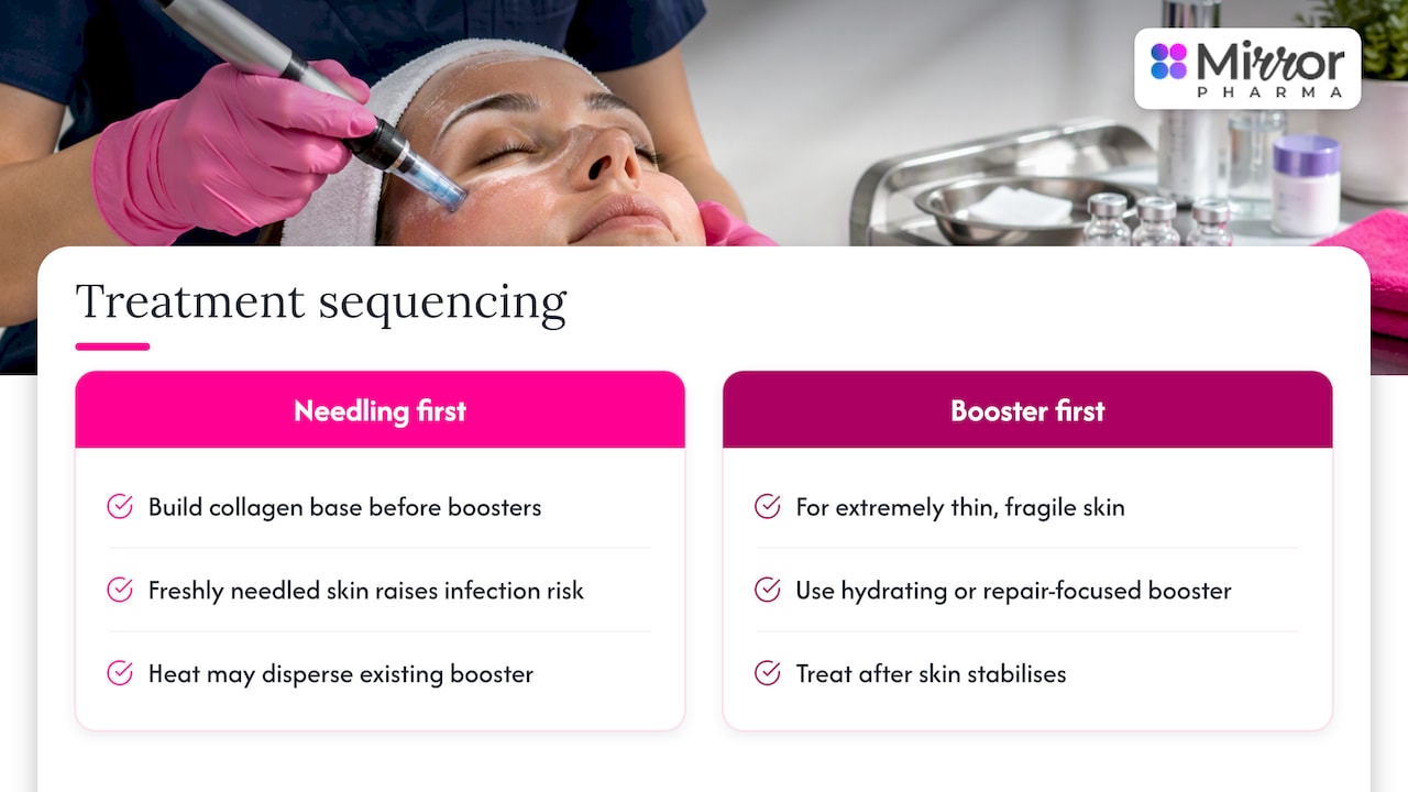 Sequencing: which goes first, and why — overview diagram